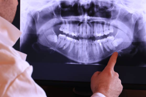 Best Knocked-Out Tooth Emergency  in Winter Haven, FL
